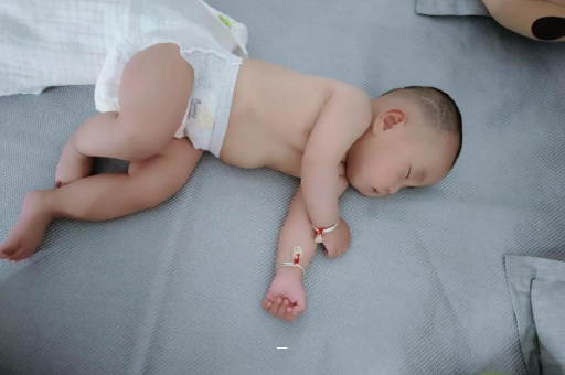 湖北宝宝脸上有白色斑块